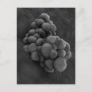 Recherche de malin cartes postales Tumeur