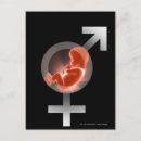 Recherche de foetus cartes postales Reproduction