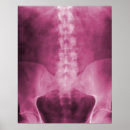 Recherche de radiologue posters Médecin