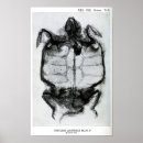 Recherche de squelette vintage posters Médical