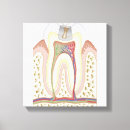 Recherche de caries dentaires Médical