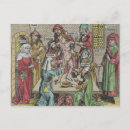 Recherche de circoncision cartes invitations Chirurgie