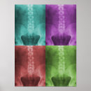 Recherche de radiologie posters Rad tech
