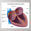 Recherche de cardiologie posters soins de santé
