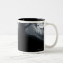 Recherche de rayons x tasses Noir et blanc