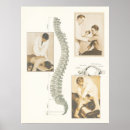 Recherche de vertébral posters Chiropraticien