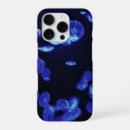 Recherche de ajustement iphone coques Mince