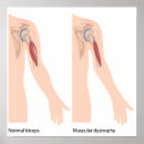 Recherche de musculaire posters Anatomie