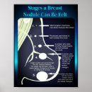 Recherche de étape posters Pour elle