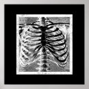 Recherche de radiographie posters Noir