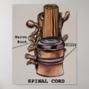 Recherche de vertébral posters Docteur