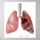 Recherche de tabagisme posters Fumeur