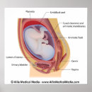 Recherche de foetus posters Développement