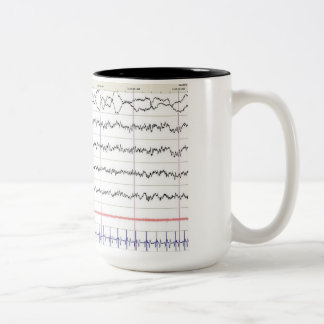 2 Couleurs Tasse d'EEG - sommeil de rem