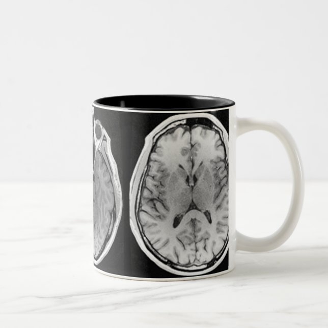 2 Couleurs Tasse d'image de cerveau d'IRM (Droit)