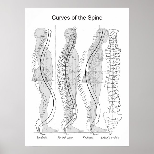 Abnormal Curves of the Spine Poster Chiropractic (Devant)