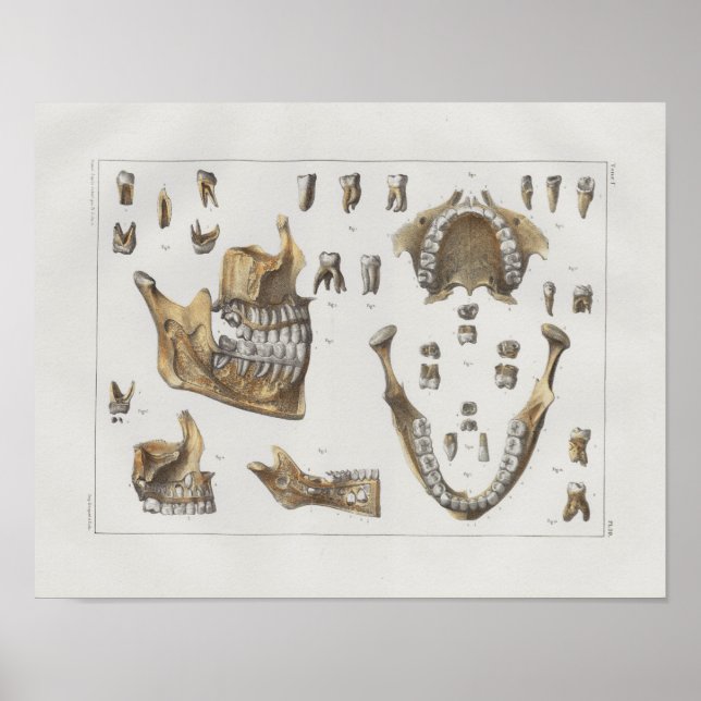 Affiche 1867 Dents de mâchoire Anatomie Vintage dentaire I (Devant)