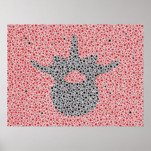 Affiche Anatomie chiropratique oeuvre Lumbar Vertebrae