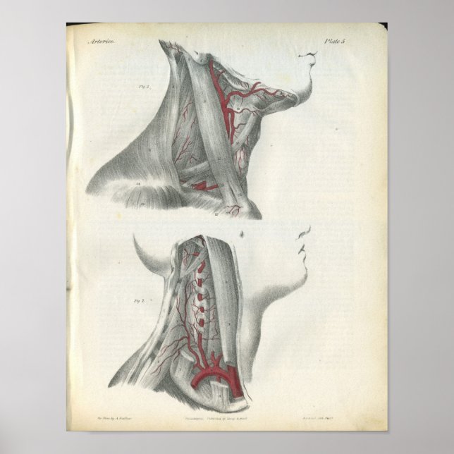 Affiche Anatomie du cou des artères vertébrales Imprimer (Devant)