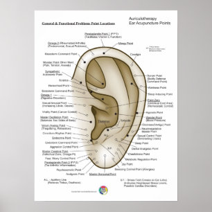 Affiche Auriculothérapie Acupuncture de l'oreille