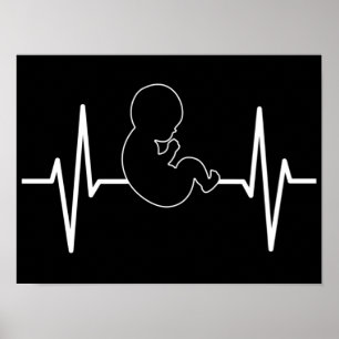 Affiche Bébé Pro-Vie poulse pulse EKG : foi chrétienne