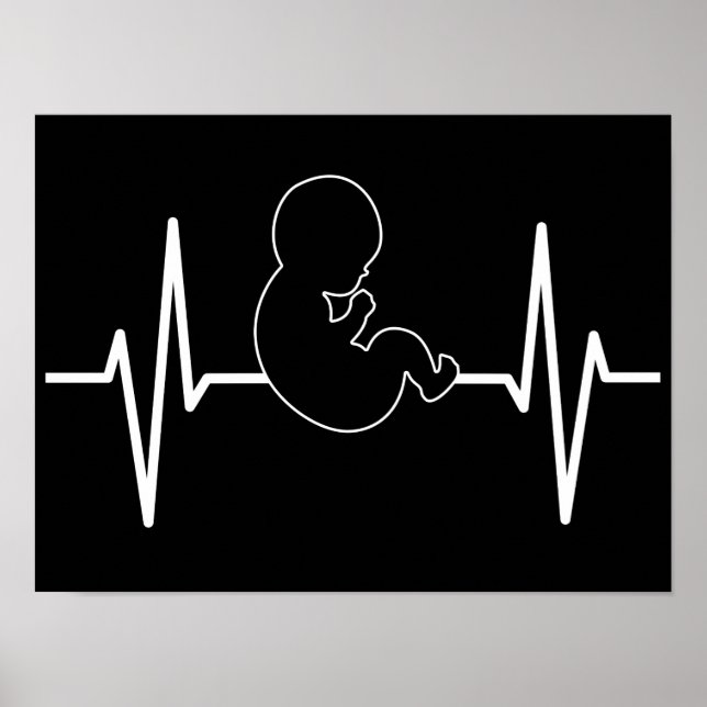 Affiche Bébé Pro-Vie poulse pulse EKG : foi chrétienne (Devant)