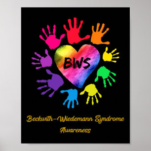 Affiche Beckwith Wiedemann Syndrome Sensibilisation mains 