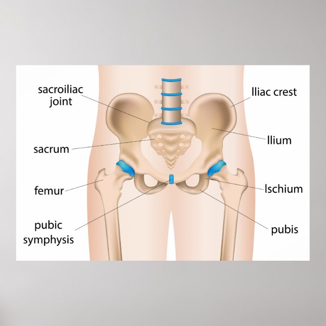 Affiche Brûlée de douleur de la hanche (Devant)