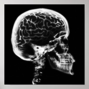 AFFICHE CERVEAU-CIEL X-RAY - NOIR ET BLANC