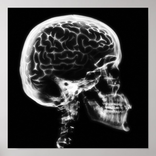 AFFICHE CERVEAU-CIEL X-RAY - NOIR ET BLANC (Devant)