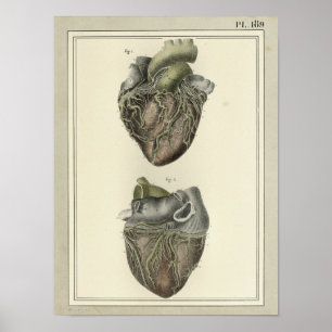 Affiche Copie 1831 d'anatomie de coeur de cru