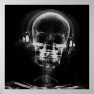 Affiche Crâne à rayons X avec casque - B&W