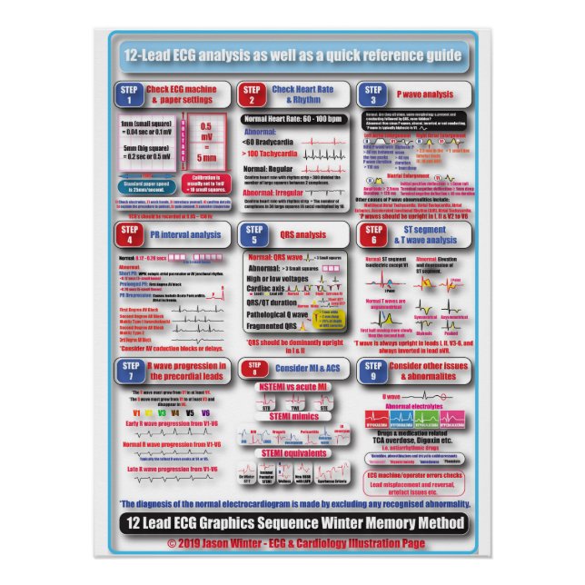 Affiche de formation ECG (Devant)