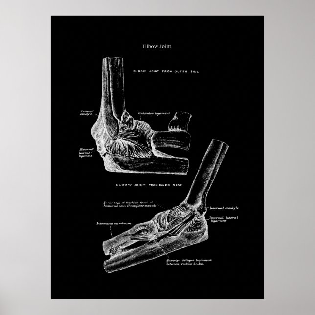 Affiche Décor du mur orthopédique de l'anatomie articulair (Devant)