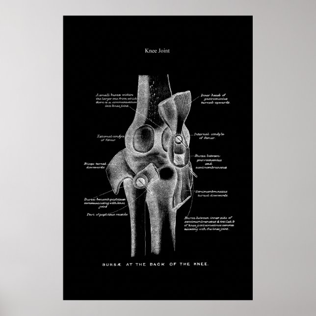 Affiche Décor Médicale de l'anatomie articulaire du genou (Devant)