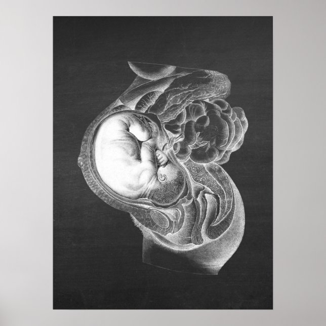 Affiche Décor n° 2 de l'anatomie de la utérus du foetus (Devant)