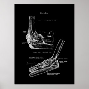 Affiche Décor oré orthopédique de l'anatomie du coude