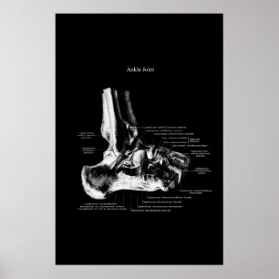 Affiche Décor Orthopédique Anatomie Conjointe