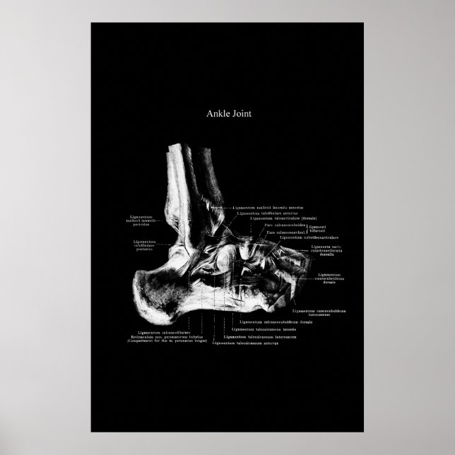 Affiche Décor Orthopédique Anatomie Conjointe (Devant)