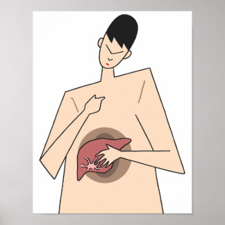 Affiche Détection précoce des maladies du foie.