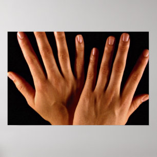 Affiche Deux mains croisées