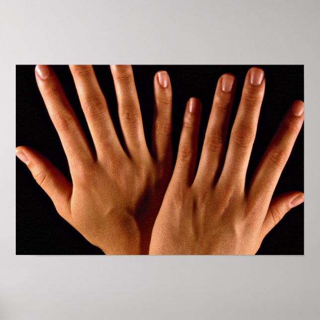 Affiche Deux mains croisées (Devant)