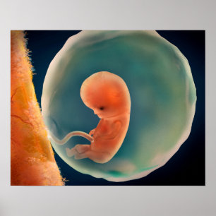 Affiche Développement Du Foetus À 9 Semaines