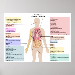 Affiche Diagram of the Manifestations of Cystic Fibrosis