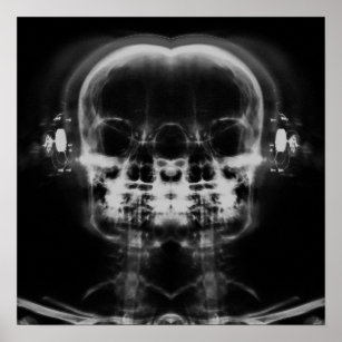 Affiche Double crâne à rayons X avec casque - B&W