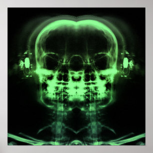 Affiche Double crâne à rayons X avec casque - Vert
