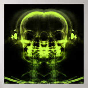 Affiche Double crâne à rayons X avec casque - Vert chaux