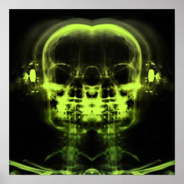 Affiche Double crâne à rayons X avec casque - Vert chaux (Devant)