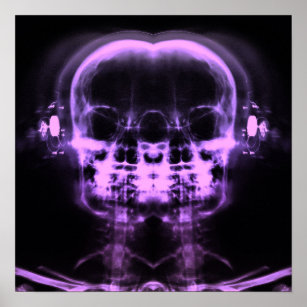 Affiche Double crâne à rayons X avec casque - violet