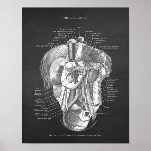 Affiche Duodenum Anatomie Art Gastroentérologue Décor (Devant)